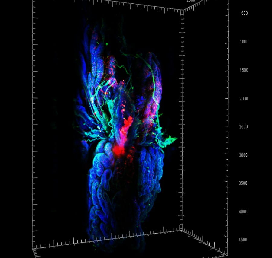 3D imaging of the mouse prostate